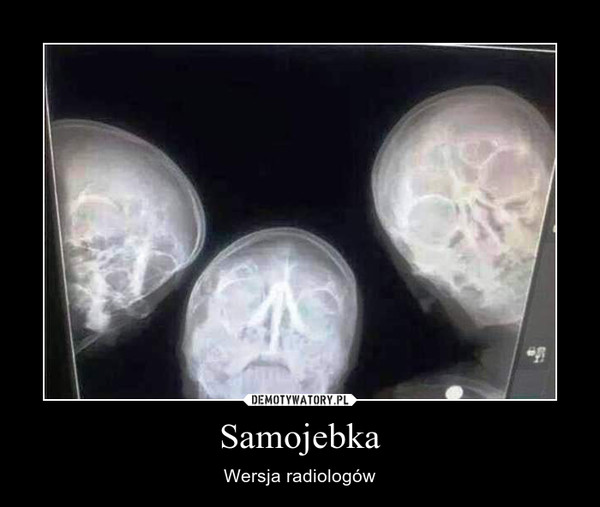 Samojebka – Wersja radiologów 