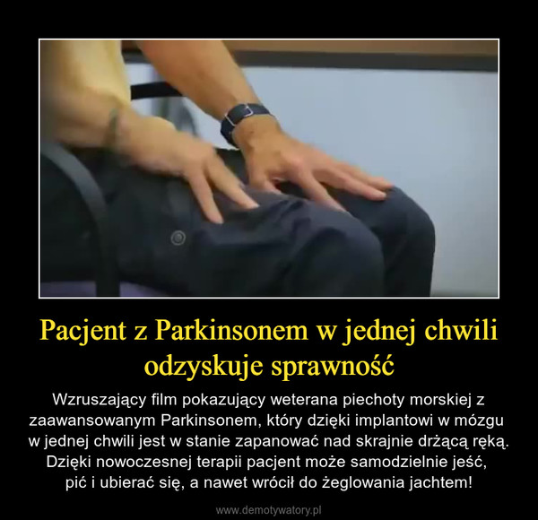Pacjent z Parkinsonem w jednej chwili odzyskuje sprawność – Wzruszający film pokazujący weterana piechoty morskiej z zaawansowanym Parkinsonem, który dzięki implantowi w mózgu w jednej chwili jest w stanie zapanować nad skrajnie drżącą ręką. Dzięki nowoczesnej terapii pacjent może samodzielnie jeść, pić i ubierać się, a nawet wrócił do żeglowania jachtem! 