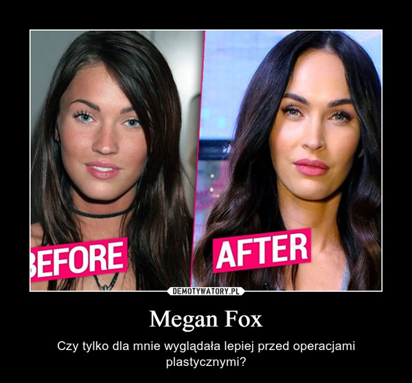 Megan Fox – Czy tylko dla mnie wyglądała lepiej przed operacjami plastycznymi? 