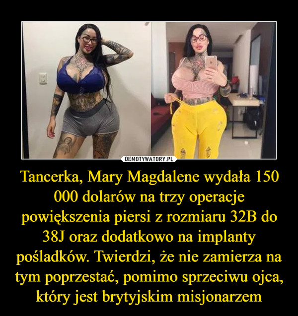 Tancerka, Mary Magdalene wydała 150 000 dolarów na trzy operacje powiększenia piersi z rozmiaru 32B do 38J oraz dodatkowo na implanty pośladków. Twierdzi, że nie zamierza na tym poprzestać, pomimo sprzeciwu ojca, który jest brytyjskim misjonarzem –  