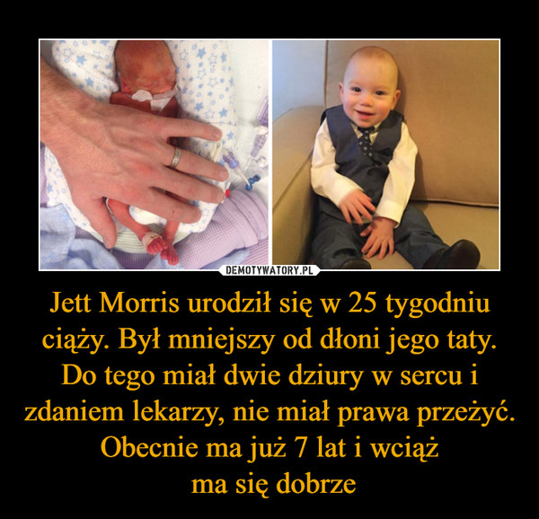 Jett Morris urodził się w 25 tygodniu ciąży. Był mniejszy od dłoni jego taty. Do tego miał dwie dziury w sercu i zdaniem lekarzy, nie miał prawa przeżyć. Obecnie ma już 7 lat i wciąż
 ma się dobrze